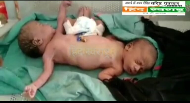 कुदरत का करिश्मा अलौकिक बच्चे का हुआ जन्म ……
