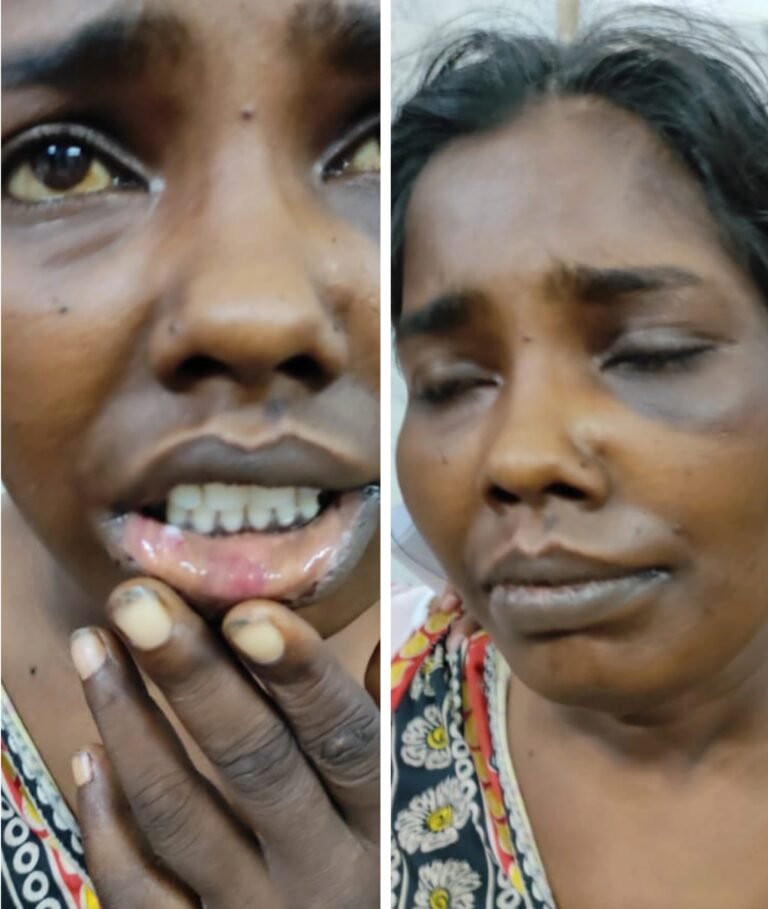 शक्की पति ने की अपनी पत्नी की बेदम पिटाई,,,मामला दर्ज कर भेजा गया जेल…