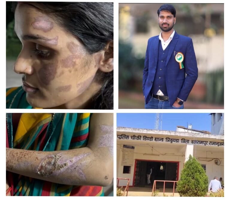 प्रोफेसर पति बना हैवान : पत्नी के साथ पार की दरिंदगी की सारी हद, शरीर पर चोट के निशान देख सहमे लोग…