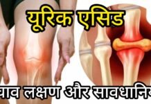 विशेष स्वास्थ्य खबर: बढ़ता हुआ Uric Acid – कारण, लक्षण, बचाव और घरेलू उपाय…